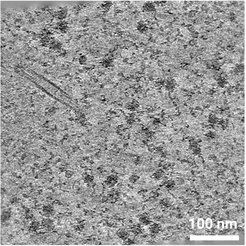 Ultradünner Schnitt einer menschlichen Zelle unter dem Elektronenmikroskop. Die größeren schwarzen Flecken auf dem grauen Hintergrund sind die Ribosomen.