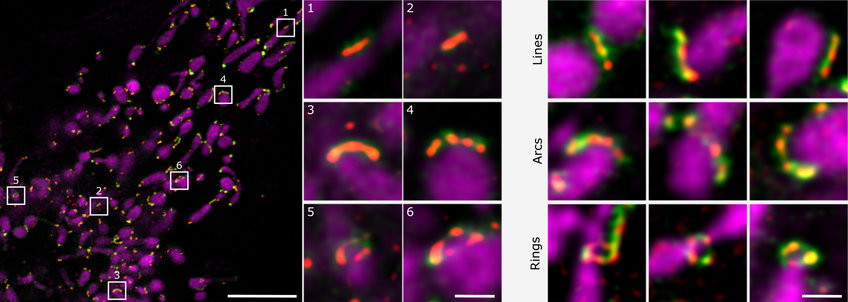 Ana J. García-Sáez – Membrane Dynamics Ana J. García-Sáez – Membrane Dynamics