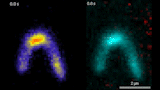 Die DNA wird mit Fluoreszenzfarbstoffen markiert und an beiden Enden an eine Glasoberfläche gebunden, um sie unter dem Mikroskop zu beobachten. Die Videos zeigen in Echtzeit, wie das Protein Smc5/6 DNA-Schlaufen bildet. Im linken Video ist zu sehen, dass das Smc5/6-Protein (rot) an die DNA (cyan) bindet und dann beginnt, die Schlaufe zu formen.